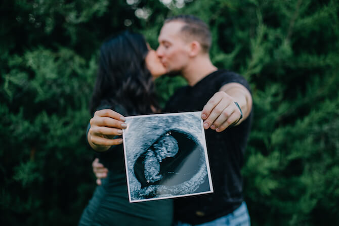 Couple kissing and holding up image of ultra-sound